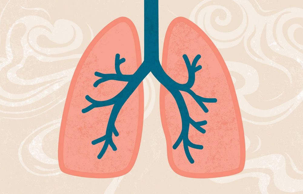 COPD Symptoms, Risk Factors, and Complications